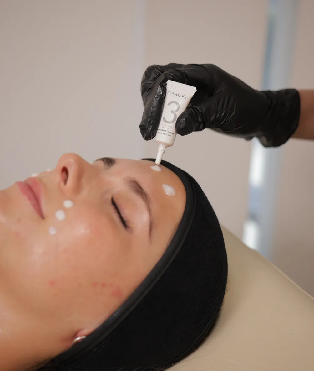 Resultado limpieza facial