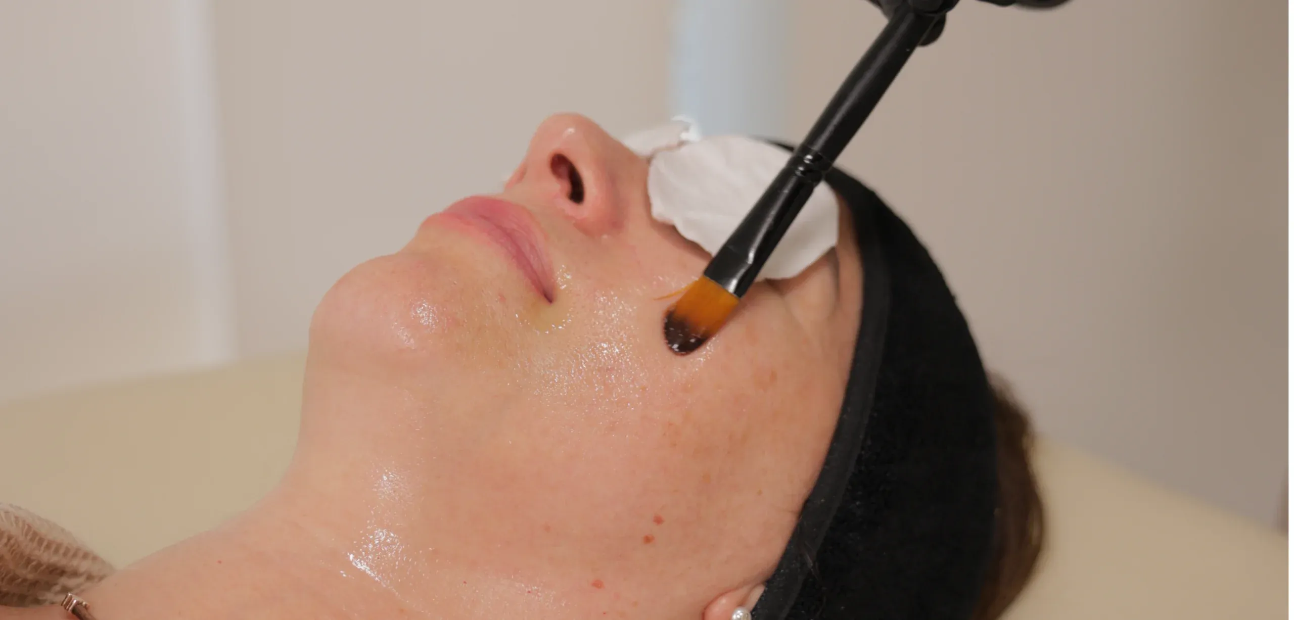 http://banner%20limpieza%20facial_