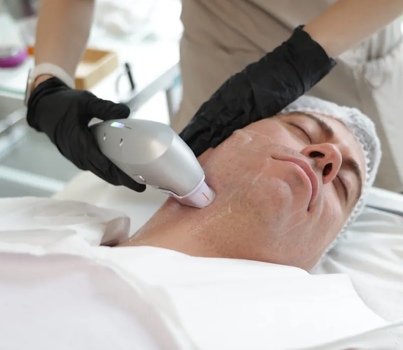 Hifu facial 2 desk